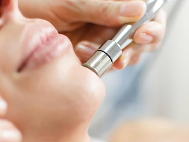 Radiant Skin with Diamond Microdermabrasion